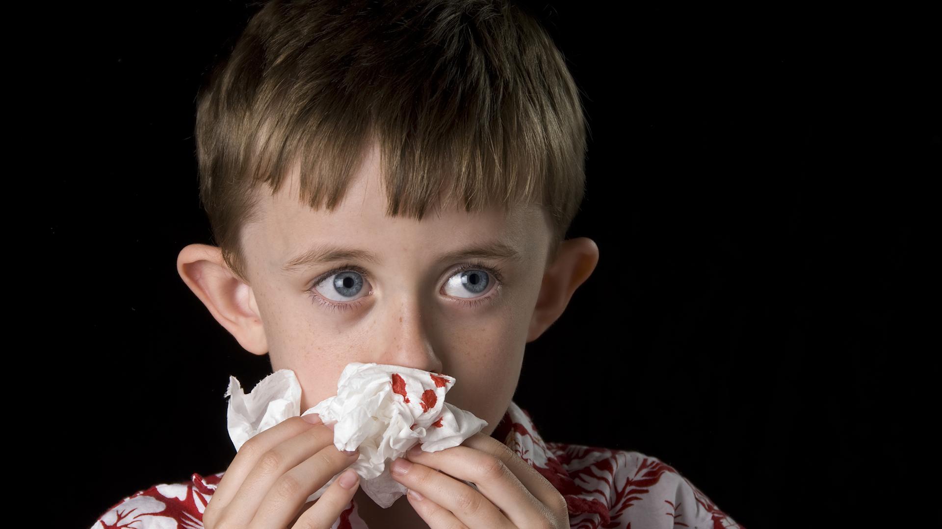 Кровотечение из носа у детей